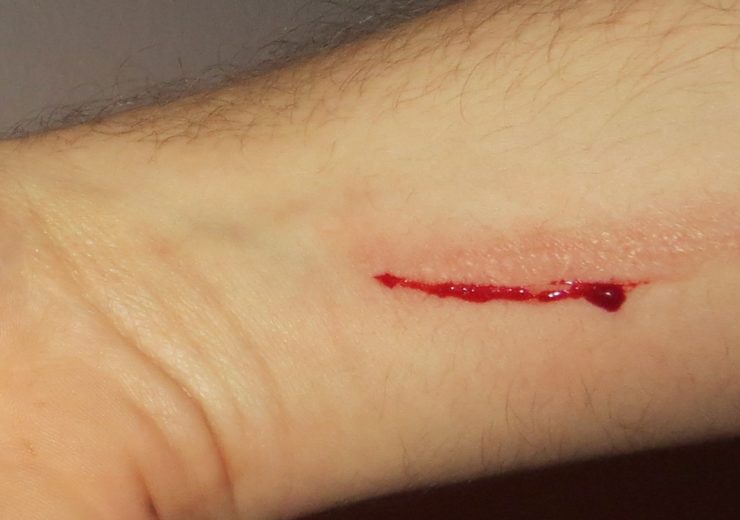 cut bleeding