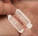 What is ZipStitch? The do-it-yourself device for closing wounds quickly wherever you are