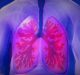 AstraZeneca, Amgen’s asthma drug tezepelumab fails in Phase 3 study