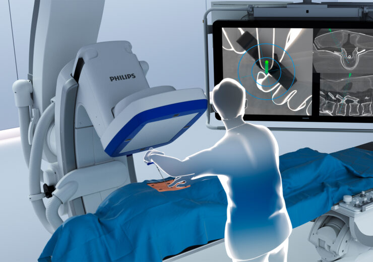 Philips rolls out AR navigation system for spine surgeries