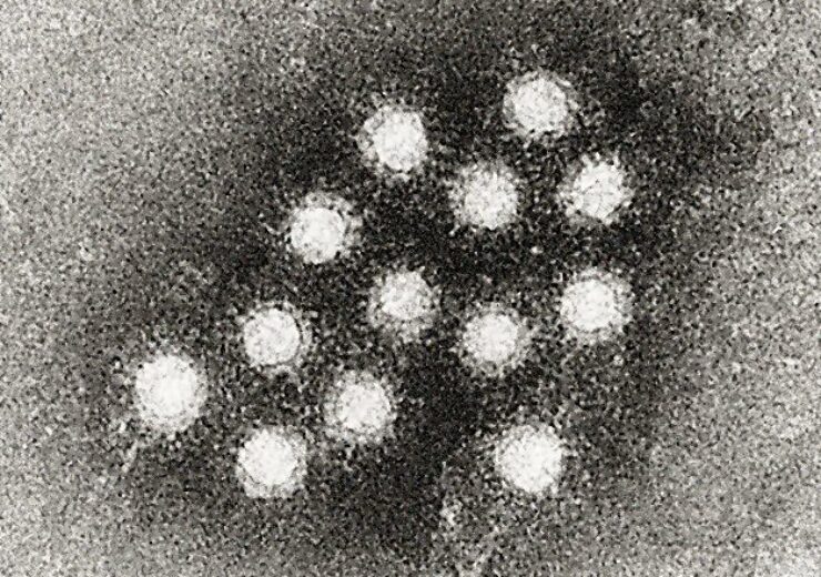Hepatitis_A_virus_02