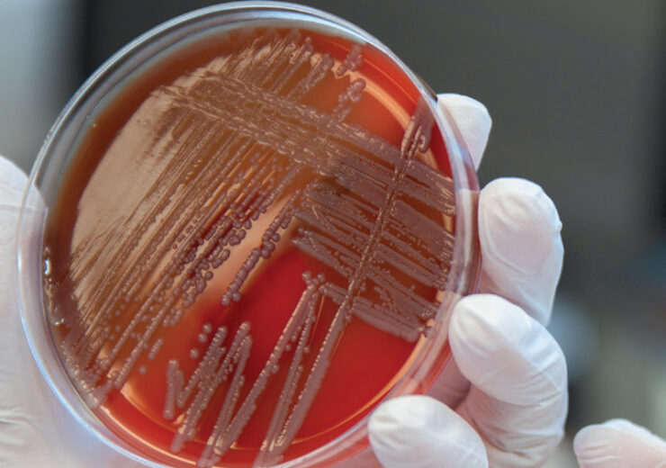 Identifying Microorganisms effectively