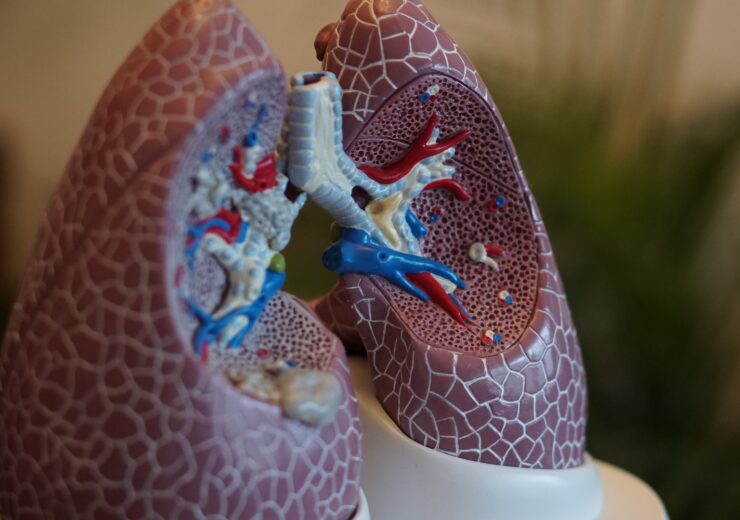 Bristol Myers Squibb’s Investigational LPA1 Antagonist Reduces the Rate of Lung Function Decline in Patients with Idiopathic Pulmonary Fibrosis