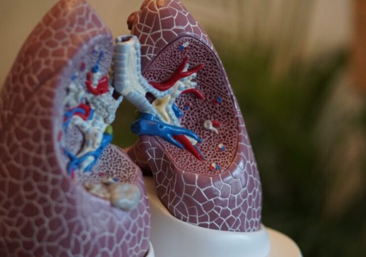 Janssen’s Rybrevant combination therapy meets primary endpoint in Phase 3 lung cancer study