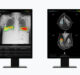 Lunit to Present Seven AI-Powered Radiology Studies at RSNA 2023