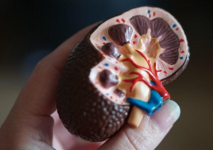 Tarpeyo kidneys