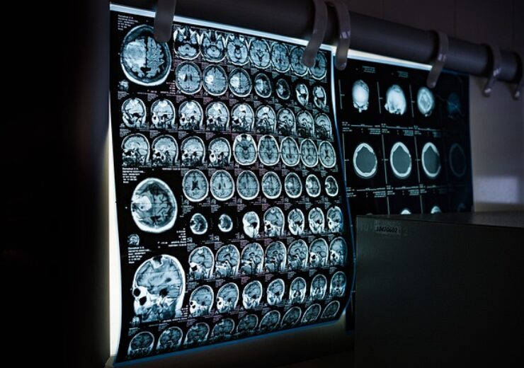 Rad AI partners with Google to advance radiology reporting with AI