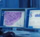 Roche enters into collaboration agreement with PathAI to expand digital pathology capabilities for companion diagnostics
