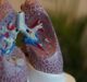 Nippon Shinyaku to market Vicore’s pulmonary fibrosis drug candidate in Japan
