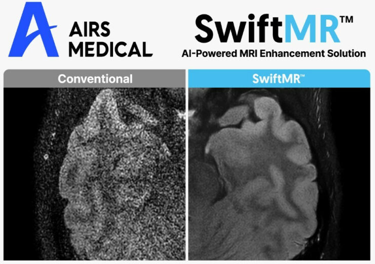 AIRS Medical Accelerates Global Expansion with MRI AI Solution SwiftMR™ Supply Contracts in Germany and the UK